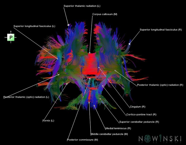 G1.T14.1.V3.C5.L1.White_matter_tracts_all.tiff