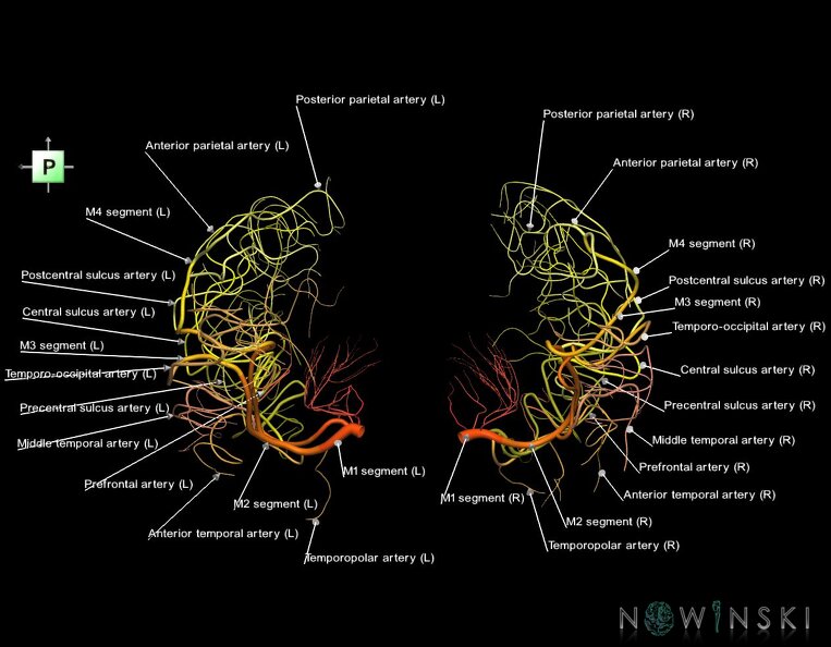 G1.T15.8.V3.C2.L1.Middle_cerebral_artery.tiff