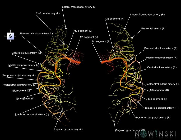 G1.T15.8.V5.C2.L1.Middle_cerebral_artery.tiff