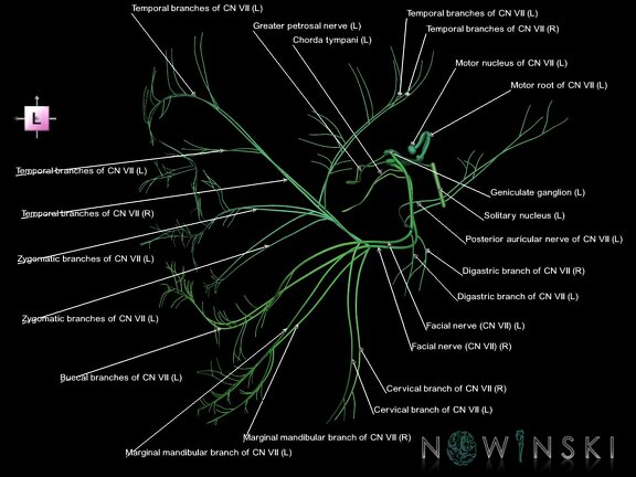 G1.T19.10.V2.C2.L1.Facial nerve