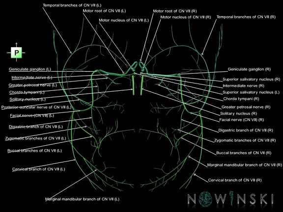 G1.T19.10.V3.C2.L1.Facial nerve