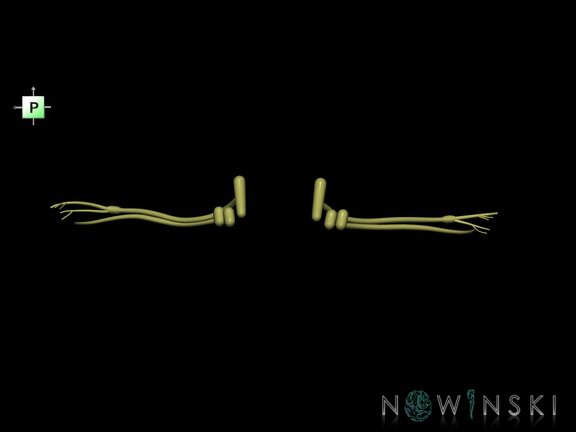 G1.T19.11.V3.C1.L0.Vestibulocochlear nerve