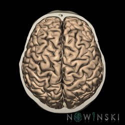 G2.T3.1-22.3.V5.C1.L0.Cerebrum whole-Skull base