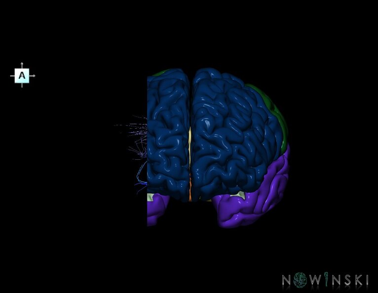 G7.T3.1-16.6.V1.Dr-30.C2.L0.Cerebrum_right_cut–Deep_veins.tiff